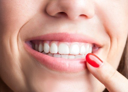 Woman pointing to healthy smile after gum disease treatment